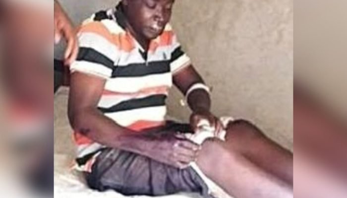 Um dos pastores agredidos pelos muçulmanos. (Foto: Reprodução/Morning Star News)